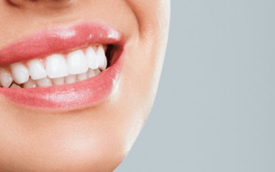 Paski do wybielania zębów: Czy warto zainwestować?